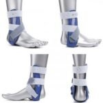 MalleoLoc is an orthosis with high functional stability, it prevents foot distortion without restricting mobility. MalleoLoc rests on the ankle from the outside and thus prevents sub-ankle subluxation. The so-called drawer symptom is prevented and the anteroventral structure of the joint capsule is protected. MalleoLoc fits well and is comfortable to wear in all types of walking, closed and sports shoes