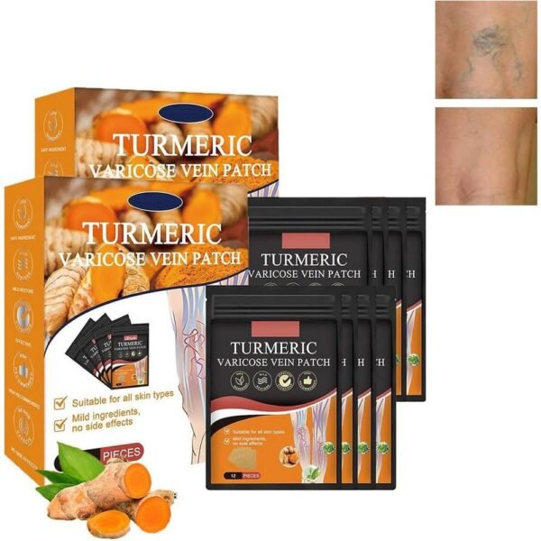 Varicose veins - Krampfadern pflaster,  Fatigue - Krampfadern pflaster